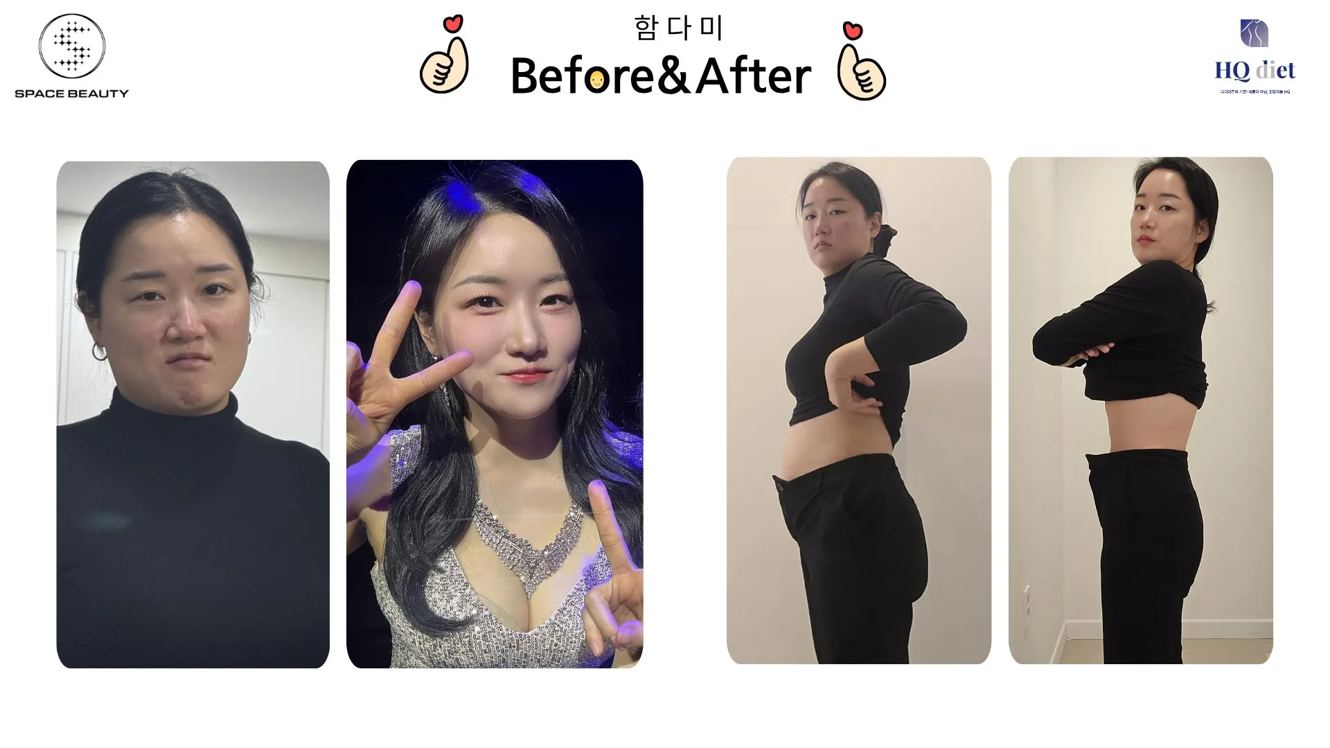 50대 여성 10주 -11kg 감량