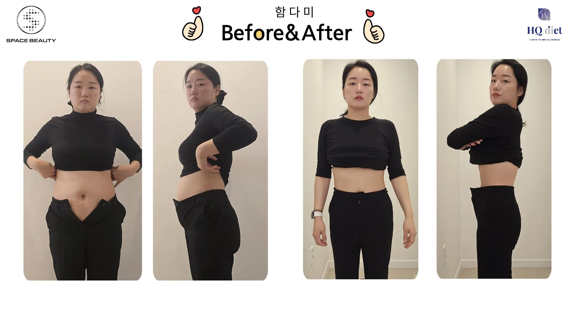 50대 한약다이어트 실패 후 -13kg 감량