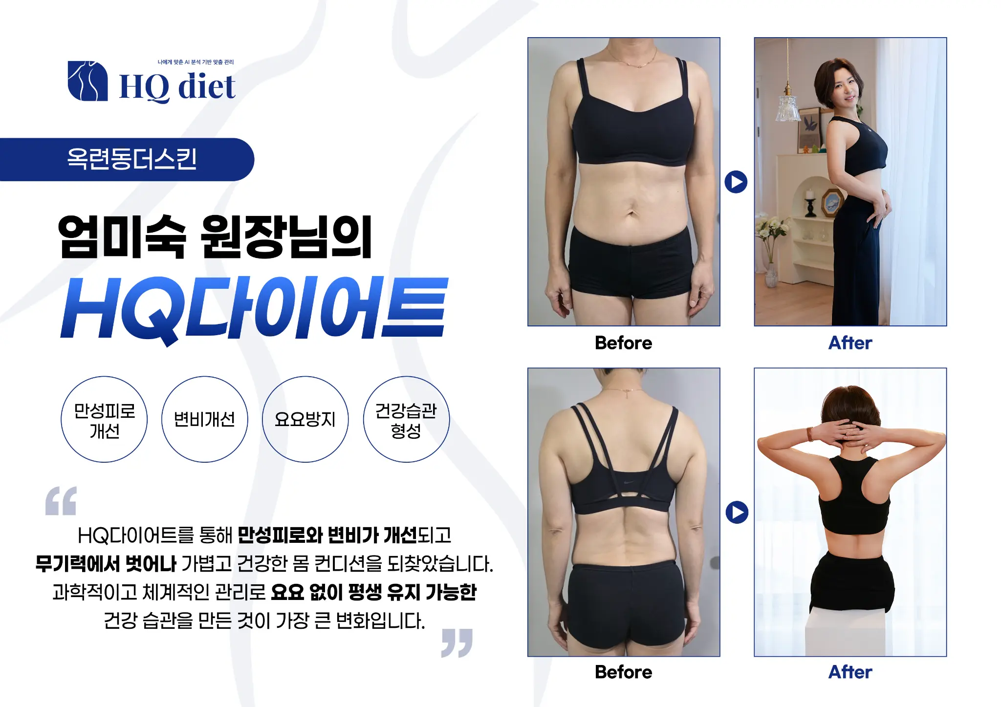 30대 여성 웨딩 준비 -7kg 감량