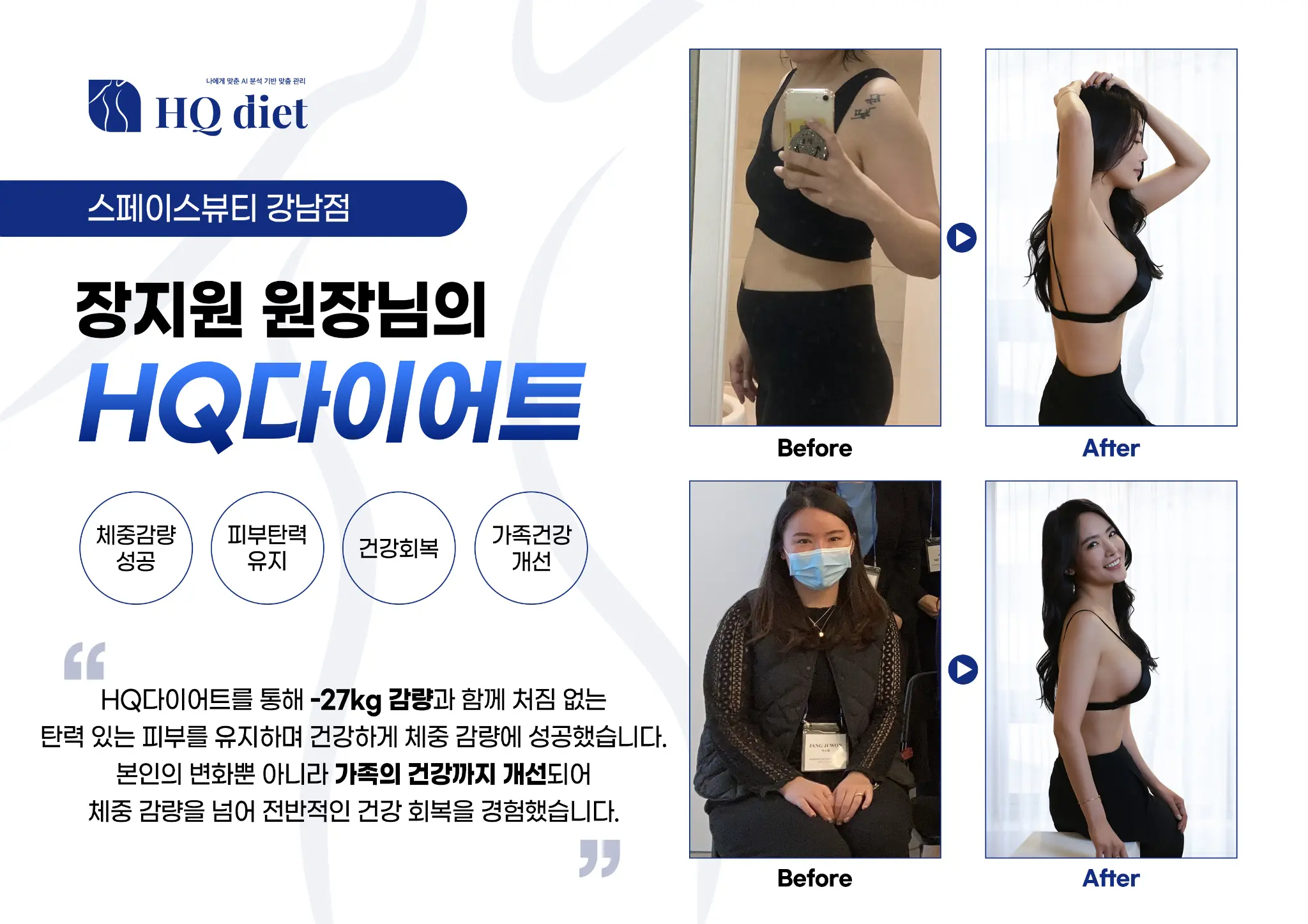 30대 여성 스트레스성 폭식 극복 -9kg