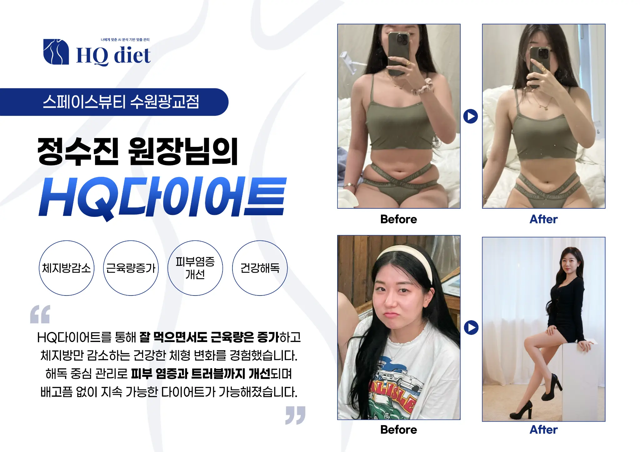 40대 여성 체형 교정 -11kg 감량