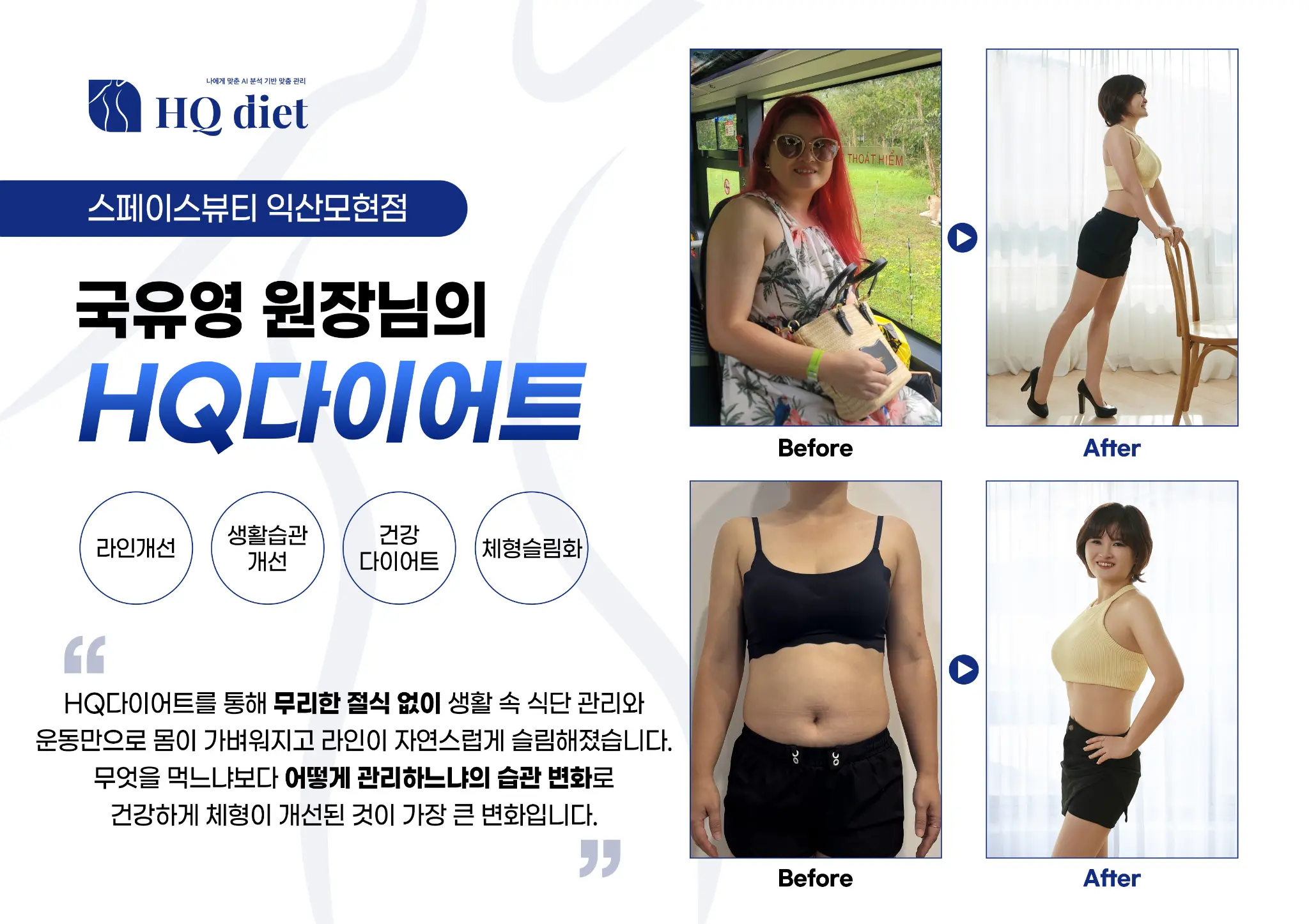 50대 남성 수면무호흡 개선 -22kg